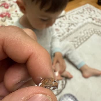 Lokum İçinden Taş Çıkması Ve Çocuğumun Sağlığı Tehlikeye Girdi
