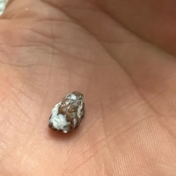 Lokum İçinden Taş Çıkması Ve Çocuğumun Sağlığı Tehlikeye Girdi
