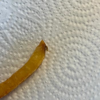 Aldığım Parmak Patatesin İçinden Böcek Çıktı, Sağlığım Tehlikeye Girdi