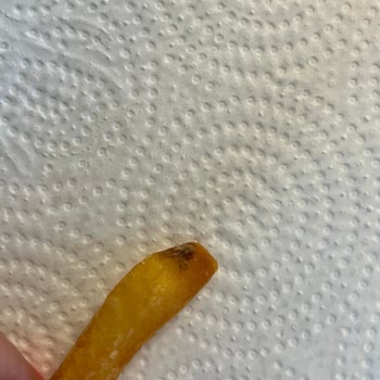 Aldığım Parmak Patatesin İçinden Böcek Çıktı, Sağlığım Tehlikeye Girdi