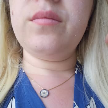 Bioderma Güneş Kremi Yüzümde Pütürlü Döküldü, İade Talebim Reddedildi