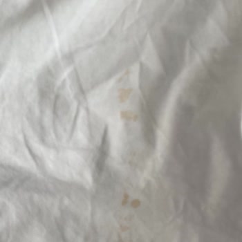 Farklı Servis Görüşleri Ve Uzayan Çözüm Süreci