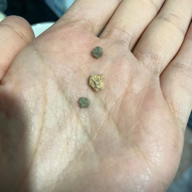 Bebek Gıdasında Kırık, Eksik Ürün Ve Taş Şoku: Güven Sarsıldı