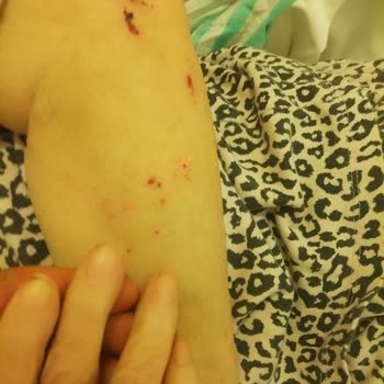 Yoğun Bakımda Annemin İhmali Ve Yüksek Tedavi Ücreti Mağduriyeti