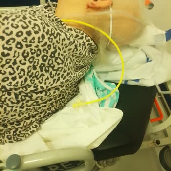 Yoğun Bakımda Annemin İhmali Ve Yüksek Tedavi Ücreti Mağduriyeti