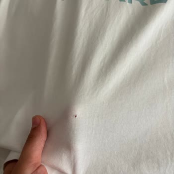 Çamaşır Makinesi Kıyafetleri Yırtıyor, Garanti Çözüm Sunmuyor