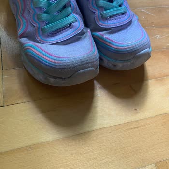 Kısa Sürede Deforme Olan Skechers Çocuk Ayakkabısı Ve Olumsuz İade Süreci