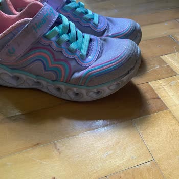 Kısa Sürede Deforme Olan Skechers Çocuk Ayakkabısı Ve Olumsuz İade Süreci