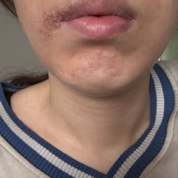 Sude Naz Güzellik Merkezi Mağduriyet Yaşama