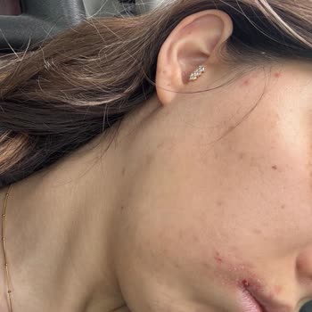 Sude Naz Güzellik Merkezi Mağduriyet Yaşama