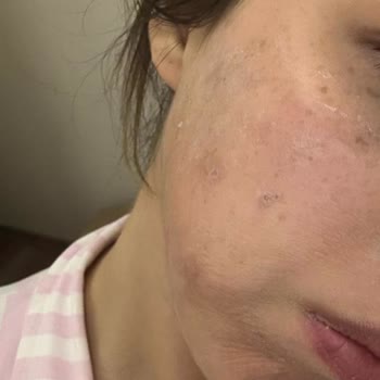 Sude Naz Güzellik Merkezi Mağduriyet Yaşama