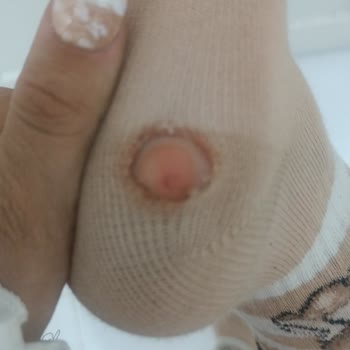 Lekeli Ve Kusurlu Ayakkabı Sağlık Sorununa Yol Açtı