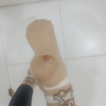 Lekeli Ve Kusurlu Ayakkabı Sağlık Sorununa Yol Açtı