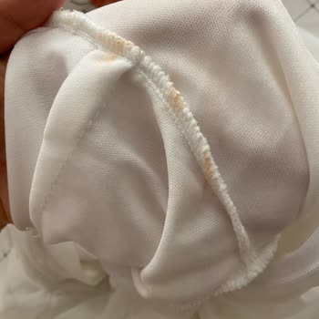 Kullanılmış Ve Lekeli Ürünün İadesi Reddedildi Trendyol Çözüm Sunmuyor