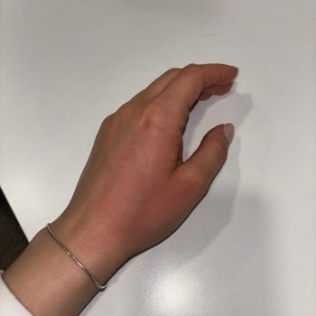 Stanley Termosun Akıntısı Elimi Yaktı