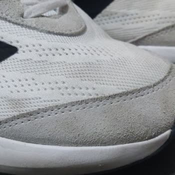 Aldığım Adidas Ayakkabıda Renk Değişimi Ve Rahatsızlık Sorunu