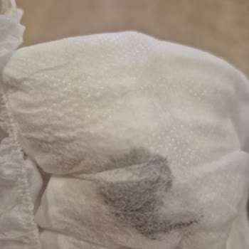 Sleepy Premium Plus Bebek Bezinde Leke Ve Kalite Sorunu!