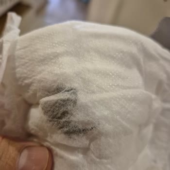 Sleepy Premium Plus Bebek Bezinde Leke Ve Kalite Sorunu!