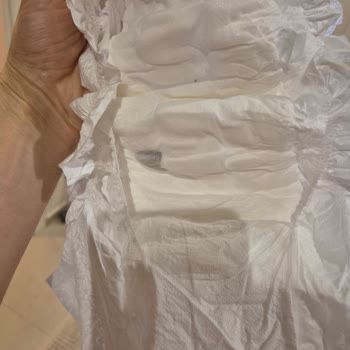 Sleepy Premium Plus Bebek Bezinde Leke Ve Kalite Sorunu!