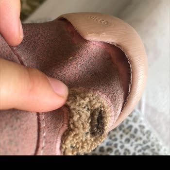 Vicco Bebek Botunda Üretim Hatası Ve Haksız İnceleme Cevabı