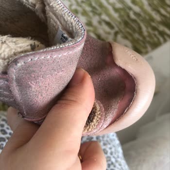 Vicco Bebek Botunda Üretim Hatası Ve Haksız İnceleme Cevabı