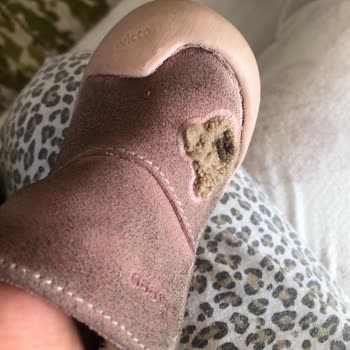 Vicco Bebek Botunda Üretim Hatası Ve Haksız İnceleme Cevabı