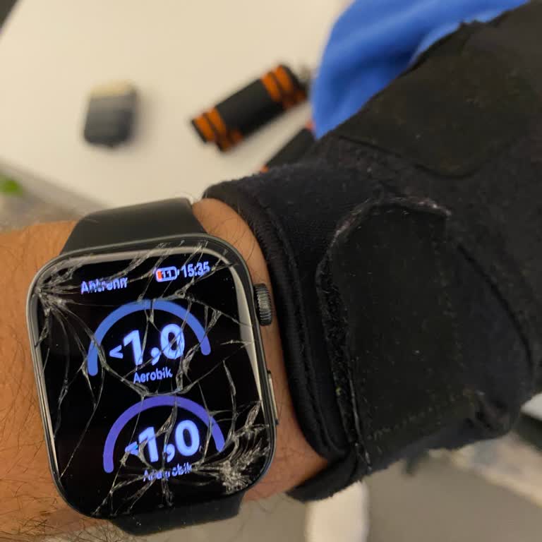 Huawei Saatte Bağlantı Ve Dayanıklılık Sorunları İle Yetersiz Servis Deneyimi