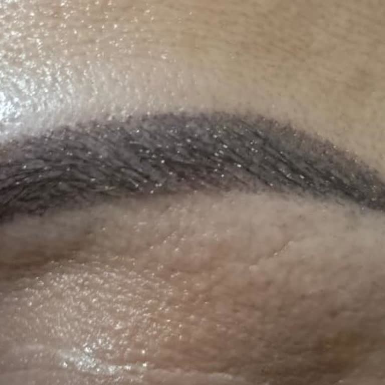 Kaş İşleminde Beklentimi Karşılamayan Sonuç Ve Memnuniyetsizlik