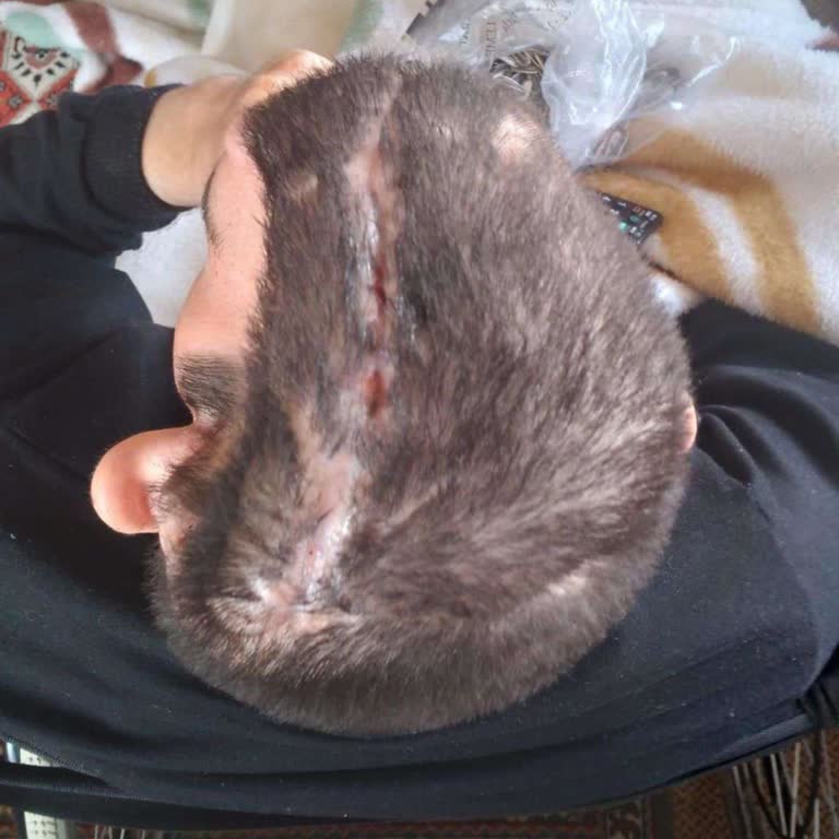 Aksigorta Tazminatı Ödemeyerek Kardeşimi Mağdur Ediyor