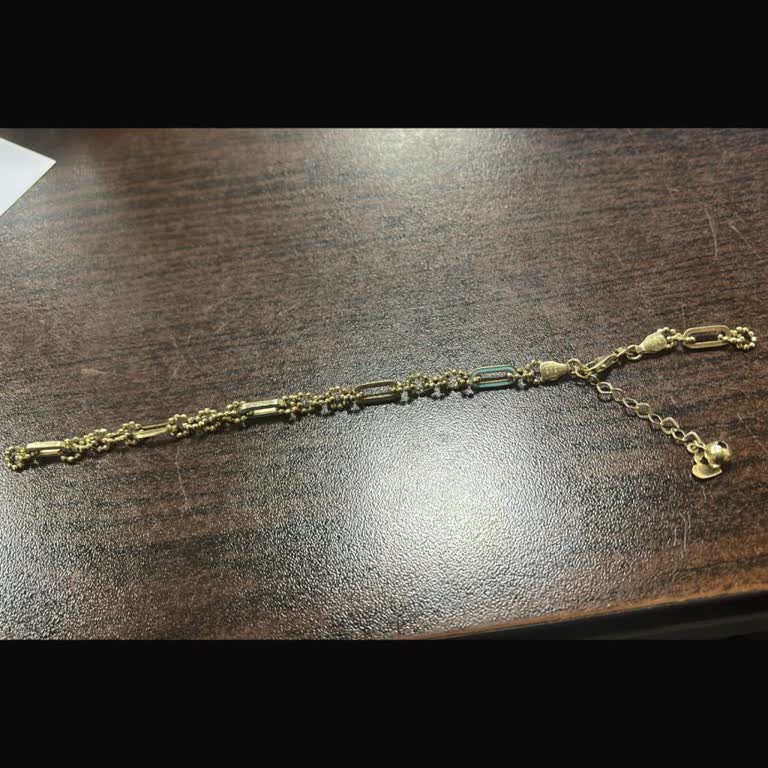 Sürekli Kopan Bileklik Sonunda Kayboldu, Mağduriyetim Nasıl Giderilecek?