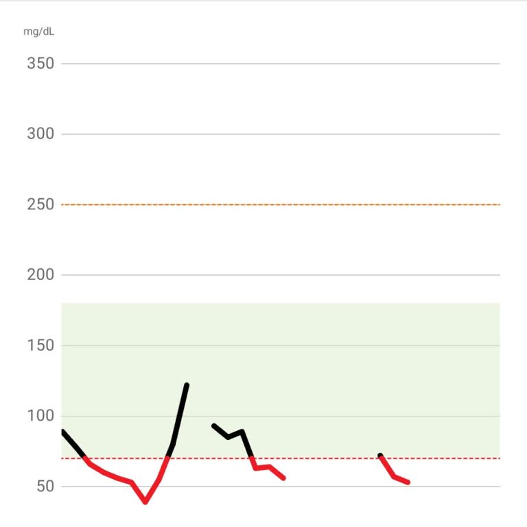 Kullanışsız Sensörler Ve Yetersiz Müşteri Hizmetleri