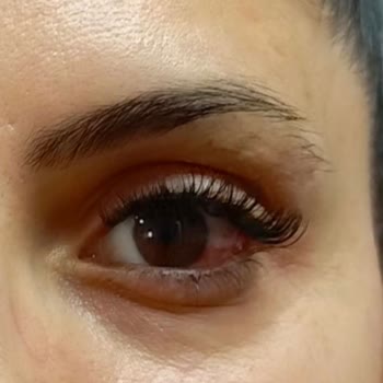 Hijyen Eksikliği Ve Sağlık Sorunları Yaşadığım Kuaför Deneyimi