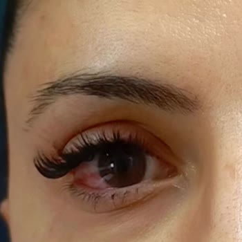 Hijyen Eksikliği Ve Sağlık Sorunları Yaşadığım Kuaför Deneyimi