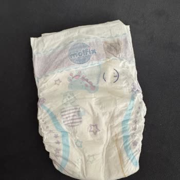 Bebek Bezinde Sakız Gibi Yabancı Maddeyle Karşılaştım