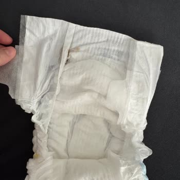 Bebek Bezinde Sakız Gibi Yabancı Maddeyle Karşılaştım