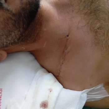 Doğa Sigorta Evrak Talebiyle Ödeme Sürecini Zorlaştırıyor