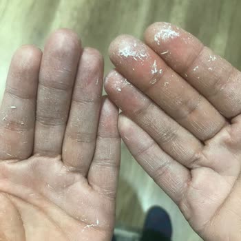 Aldığım Güneş Kremi Pütürlü Çıktı, Orijinallik Sorumluluğu Bana Bırakıldı