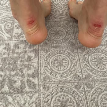 Ayakkabının Arka Dikişleri Ayaklarımı Ciddi Şekilde Yaraladı, İade Talep Ediyorum