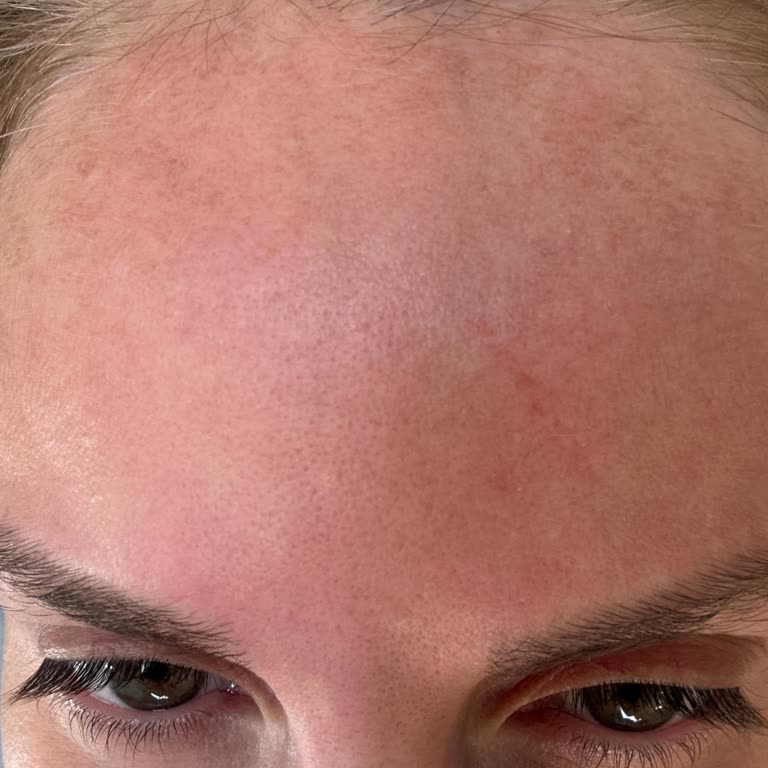 Missha Pirinç Özlü Maske Cildimde Şiddetli Yanma Ve Kızarıklık Yaptı