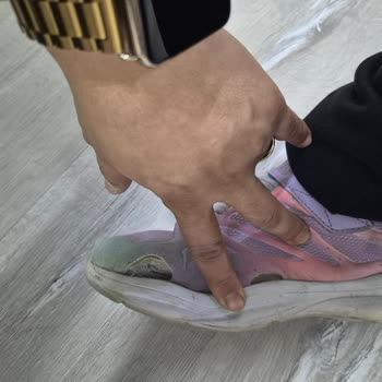 Skechers Ayakkabı 2 Ayda Deforme Oldu İade Talebim Reddedildi