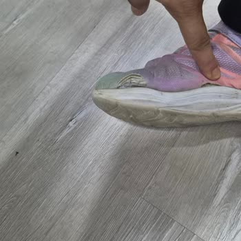 Skechers Ayakkabı 2 Ayda Deforme Oldu İade Talebim Reddedildi
