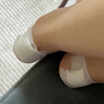 Tommy Hilfiger Ayakkabı Sağlığımı Tehdit Etti, Boyner İlgisiz Kaldı!