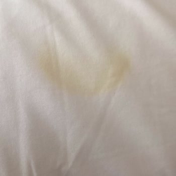 Yanlış Ve Lekeli Ürün, Çözüm Yerine Mağazalar Arası Yönlendirme