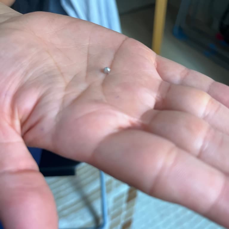 Aldığım Kıymadan Metal Benzeri Yabancı Madde Çıktı, Sağlığım Tehlikeye Girdi