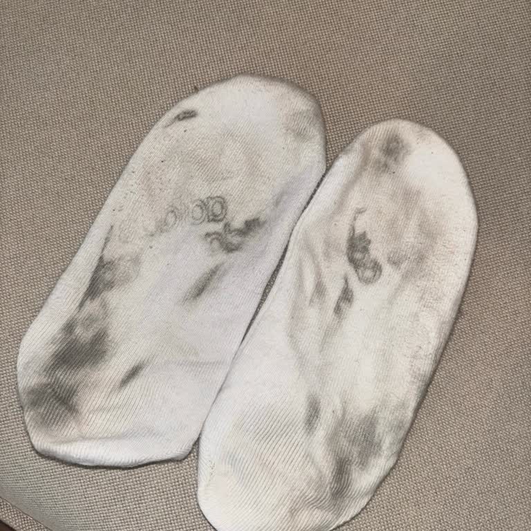 Aldığım Adidas Ayakkabının Taban Yazısı Çorabıma Geçti İade Talebim Reddedildi