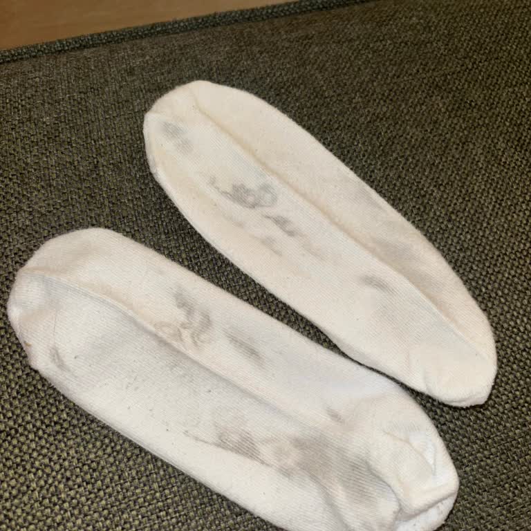 Aldığım Adidas Ayakkabının Taban Yazısı Çorabıma Geçti İade Talebim Reddedildi