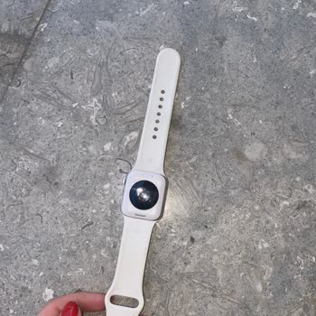 Zara Ceketinden Akan Boya Apple Watch Saatime Zarar Verdi, Mağduriyetim Giderilmedi