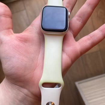 Zara Ceketinden Akan Boya Apple Watch Saatime Zarar Verdi, Mağduriyetim Giderilmedi