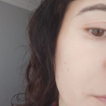 Dermoskin Güneş Kremi Yüzde Pütürlenme Ve Göz Yanması Sorunu