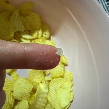 Ruffles Cipsin İçinden Yabancı Maddeler Çıktı, Sağlığım Tehlikeye Girdi